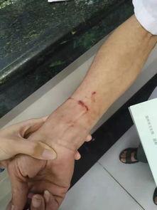 温州网友打架爆料事件视频,网络暴力引发现实冲突  第2张